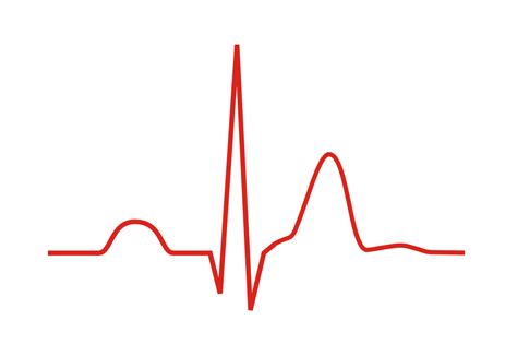 Syndrome Du Qt Court Arythmie Cardiaque