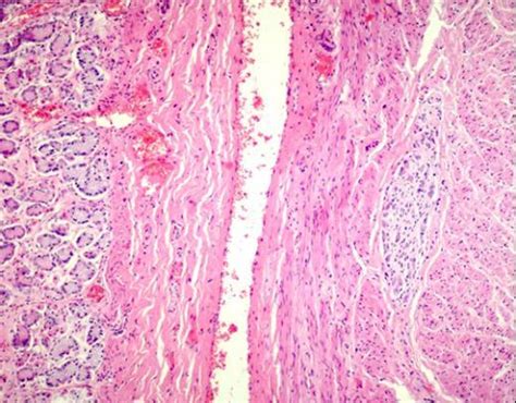 Myenteric Plexus Of Auerbach In The Canine Stomach Low Power