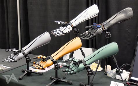 This robotic arm is part prosthetic, part fashion statement