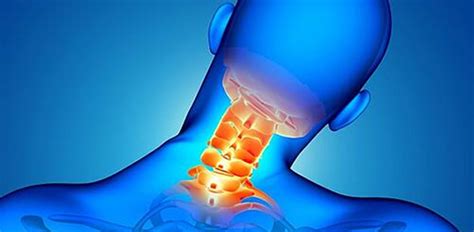 2nd Opinion Radiology Report On Craniocervical Instability Cci