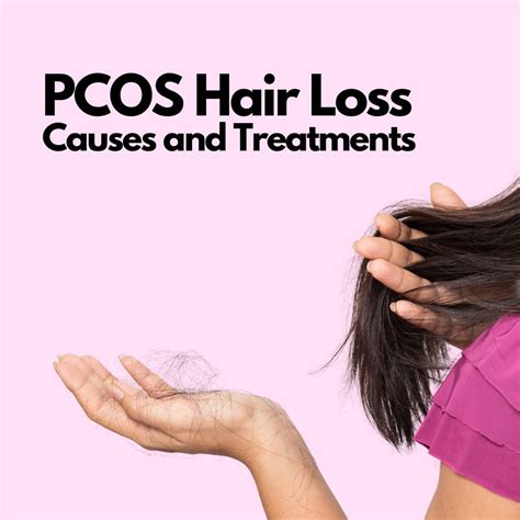 Pcos Hair Loss Causes And Treatments Vantage Hair