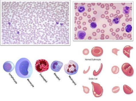 Preparation of blood smear