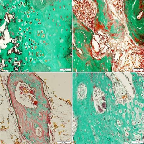 Photomicrographs Of Histological Sections Staining Masson Goldner