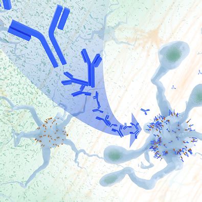 Study suggests treatments that unleash immune cells in the brain could help combat Alzheimer’s ...