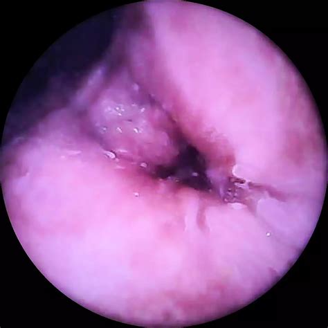 Cam In My Pussy Austrian Webcam Webcam Porn XHamster