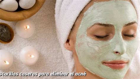 Introducir Imagen Recetas Caseras De Acne Abzlocal Mx