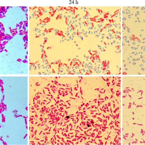 The Colonial Morphology Of B Cereus 09 And Its Mutants Tested