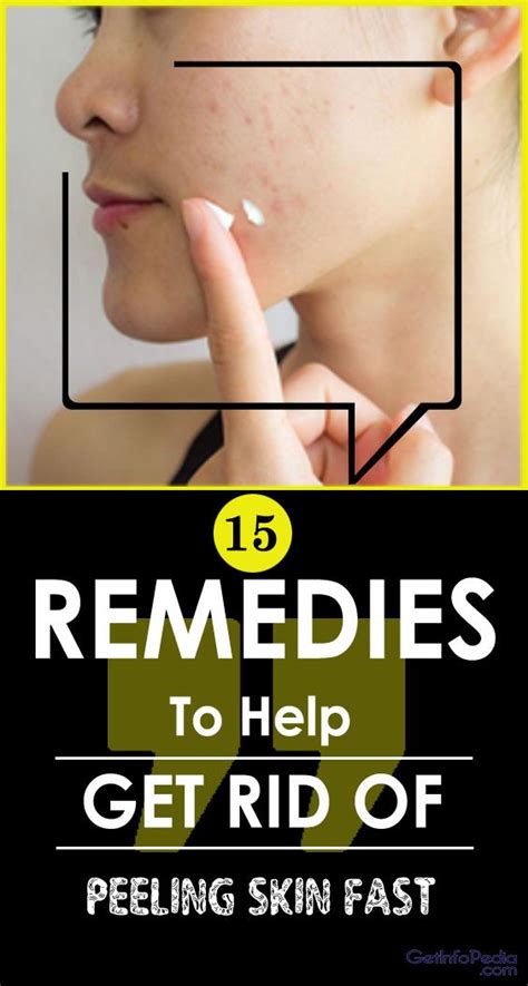 15 Remedies To Help Get Rid Of Peeling Skin Fast Peeling Skin Skin