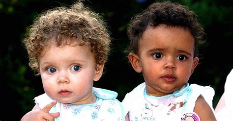 Sisters Who Looked Almost Identical At Birth Grow Up To Have Different