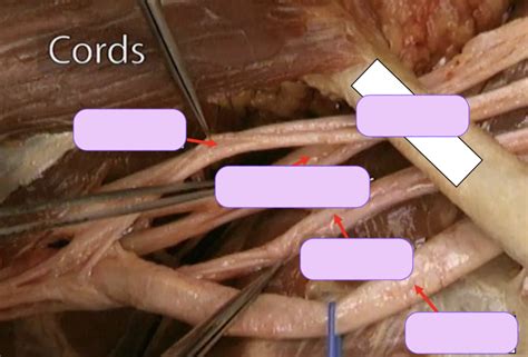 Upper Extremity Brachial Plexus Part 2 Diagram Quizlet