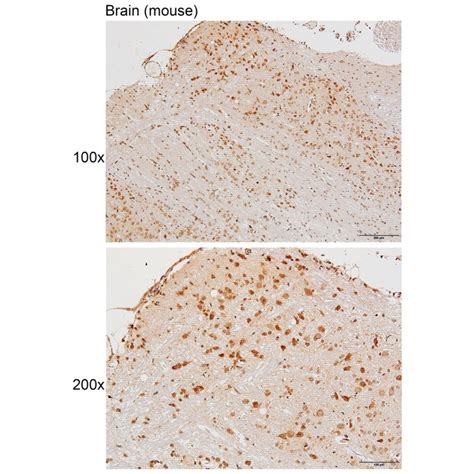 Solarbio K111458P Anti P2RX1 Polyclonal Antibody 试剂仪器耗材