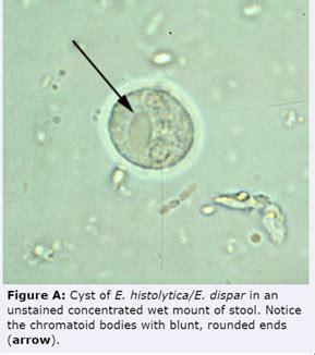 Dientamoeba Fragilis Troph