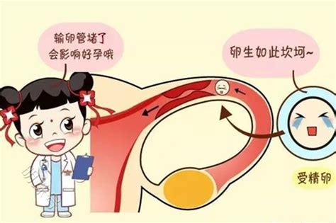 怀不上孩子——输卵管性不孕是大“元凶”！女性疾病频道东方养生