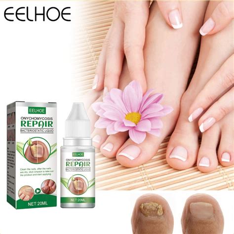 Nail Fungus Treatment Fungus Nail Treatment Nail Repair Liquid