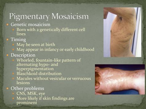 Ppt Disorders Of Pigmentation Powerpoint Presentation Free Download