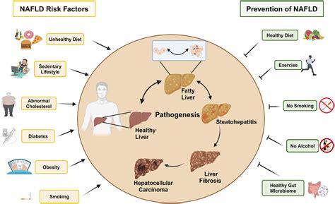 Nonalcoholic Fatty Liver Disease And Gut Liver Axis Role Of Intestinal