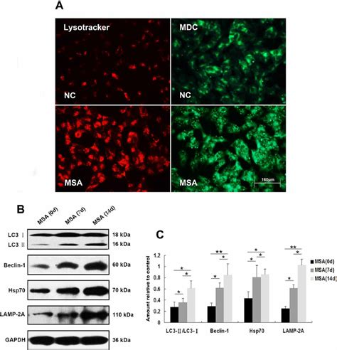 Induction Of Autophagy In SH SY5Y Cells Following Exposure To MSA CSF