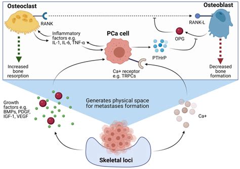 Prostate Cancer Bone Metastases Biology And Clinical Management Review