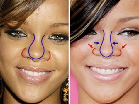 Rihanna A Plastic Surgeons View Orange County Register