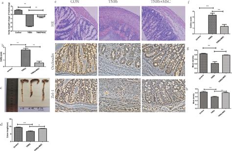 Human Umbilical Cord Derived Mesenchymal Stem Cell Huc Msc Therapy