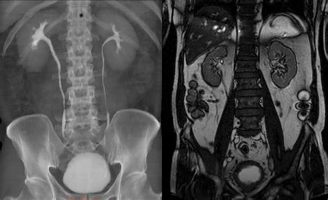 Uro Tac Studio Di Radiologia Palumbo Centro Di Diagnostica Per