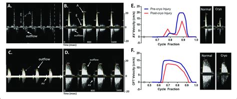 Adult Zebrafish Blood Flow Velocity Waveforms Ac Waveforms