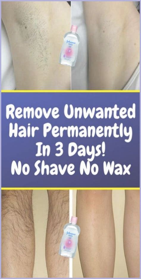 Remove Unwanted Hair Permanently In Three Days No Shave No Wax Artofit