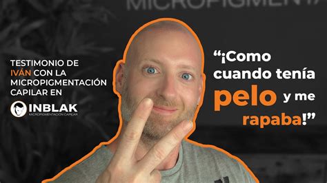 Iván testimonio en vídeo de micropigmentación capilar INBLAK