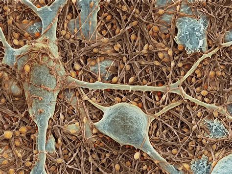 Nerve Cells And Glial Cells Sem Photograph By Thomas Deerinck Ncmir