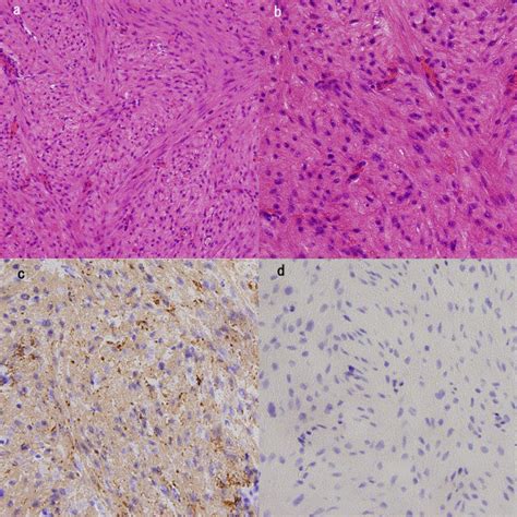 Histopathological Examination A B Histopathological Examination Of Download Scientific