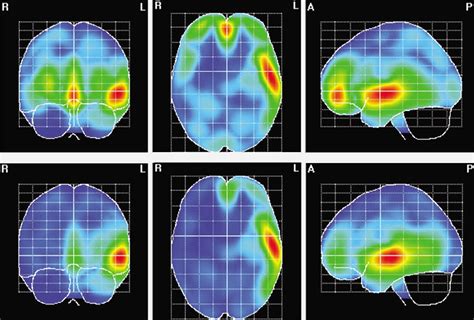 El cerebro de hombres y mujeres responde diferente ante una película