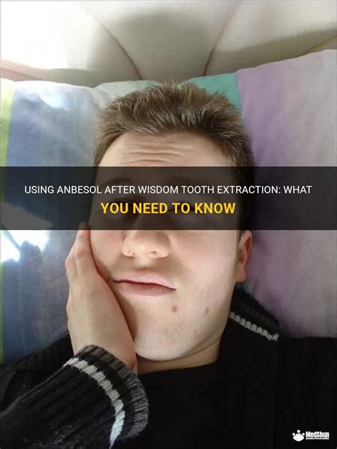 Using Anbesol After Wisdom Tooth Extraction What You Need To Know Medshun