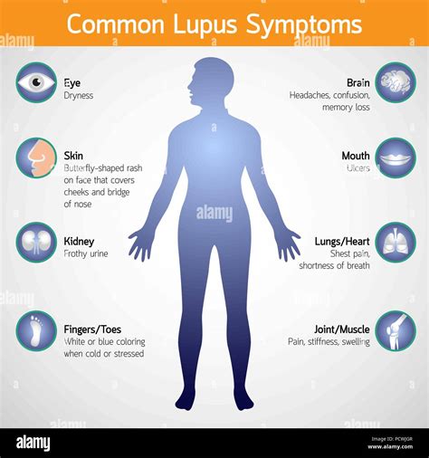 Les Sympt Mes Du Lupus Commun Ic Ne Logo Vector Illustration Image