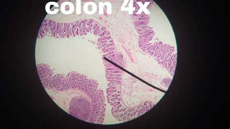 Colon Histology