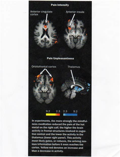 Dr. Mike Klaybor CBT Therapist - Blog: Pain & the Brain: Is your pain ...