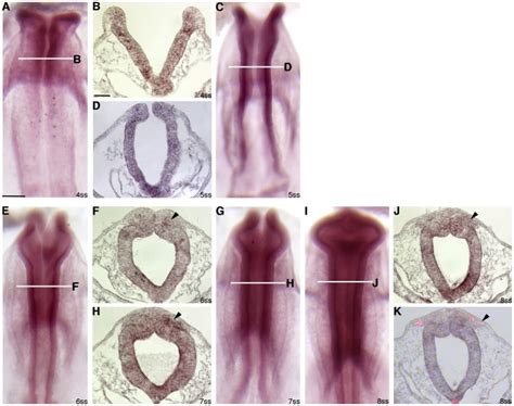 A C E G I Whole Mount In Situ Hybridization For Annexin A6 Followed