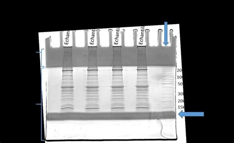 Prise d image d une migration sur gel SDS PaGE de protéines