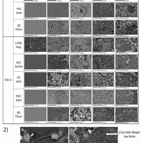 1 Sem Image Showing Microbial Colonization On The Different