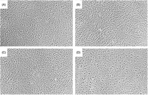 Appearance Of Arpe Cell Cultures Maintained In Confluent Conditions