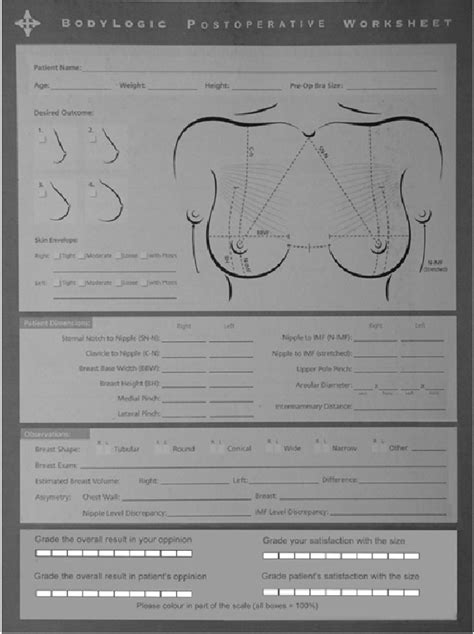 The Use Of An Anthropometric Based Preoperative System To Choose