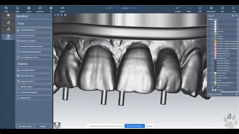 Cad Lynx Evolution Webinar Sandbox Faccette A Cura Di Andrea Cassola