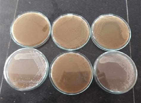 Lactobacillus Mrs Agar Plate With Different Morphology Of Lab