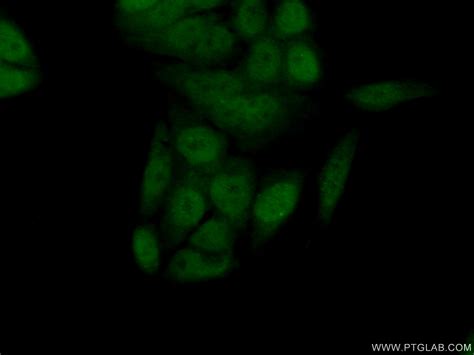 Centromere protein R antibody (10743-1-AP) | Proteintech | 武汉三鹰生物技术有限公司