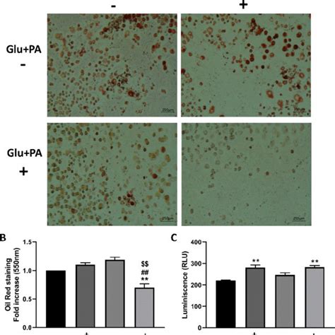 3t3 L1 Adipocytes Showed A Reduction Of Lipid Accumulation When