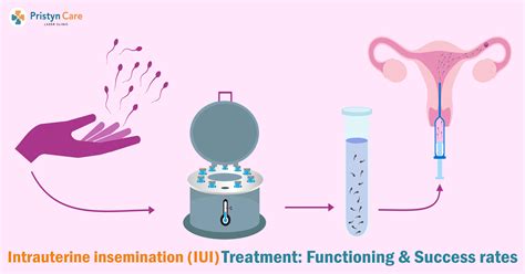 At Home Insemination Success Rates Homemade Ftempo