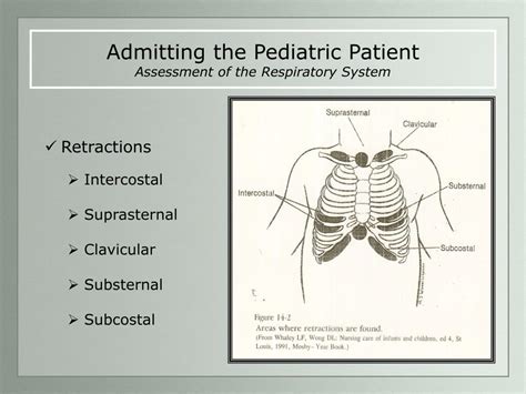 Ppt Admitting The Pediatric Patient Assessment Of The Respiratory System Powerpoint