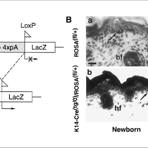 Characterization of Cre recombinase activity in K14-Cre transgenic ...