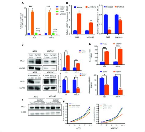 FOXC1 Promotes GC Cell Proliferation Via Downregulation Of DKK1 A