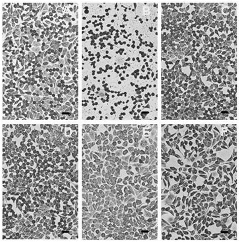 Light Micrographs Of L929 Cells Cultured With Empty Liposomes C