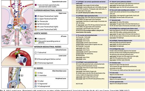 Paratracheal Lymph Nodes Lung Cancer